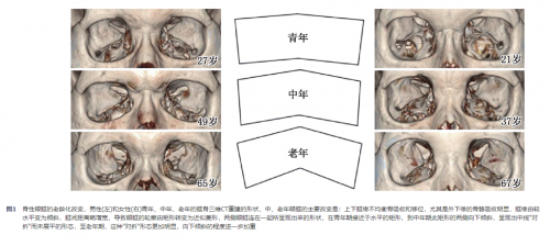 北京好年华：上了年纪的人群，为什么会变成三角眼